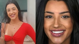 Bia Miranda gasta R$ 27 mil com preenchimento e lentes; veja antes e depois