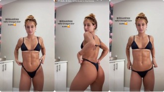 Bruna Griphao exibe barriga trincada após procedimento estético