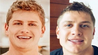 Lucas Gallina passa por procedimento estético