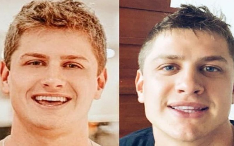 Lucas Gallina passa por procedimento estético