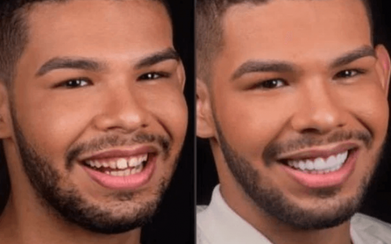 Saiba quanto custou a mudança radical de Vyni do BBB22