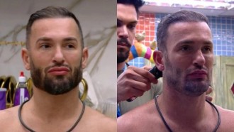 Diego Hypolito fez transplante capilar antes do BBB 25; médico conta detalhes do procedimento