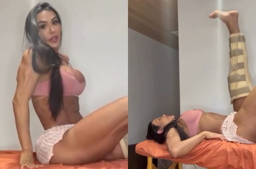Gracyanne Barbosa mostra fisioterapia após cirurgia e fala de recuperação: 'Com vontade ou não'