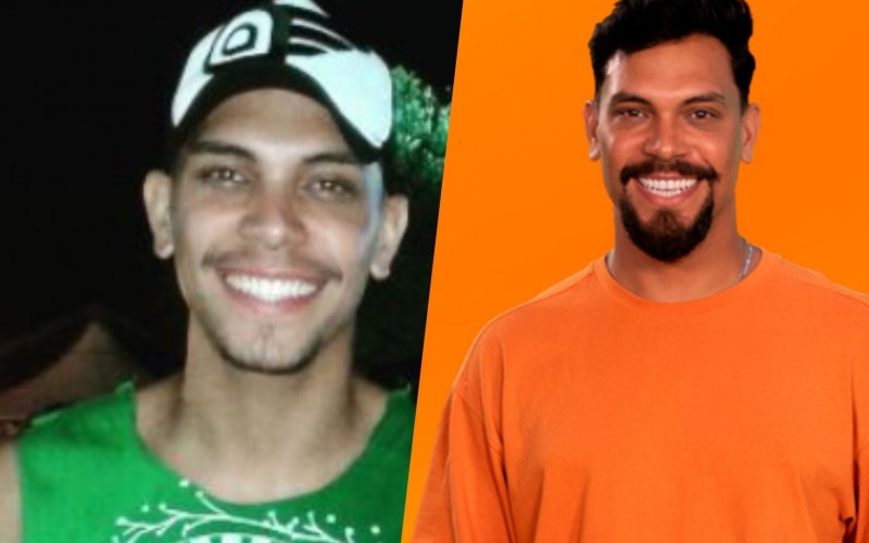 Cirurgia ortognática, botox e rinoplastia: veja os procedimentos estéticos dos brothers do BBB 25