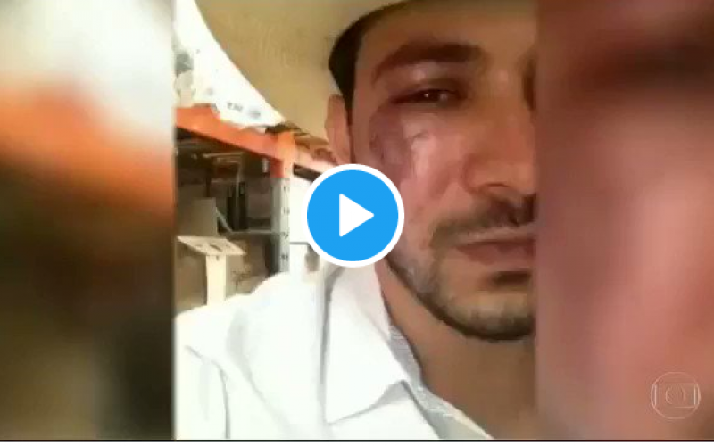 Caio Afiune, do BBB21, sofre agressão física, fica com o olho roxo e aparece na Globo com o rosto desfigurado