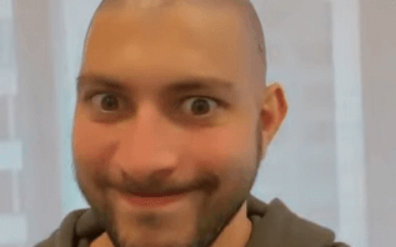 Ex-BBB Caio Afiune surge careca e mostra cabeça