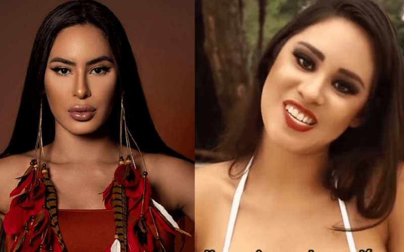 Isabelle, do ‘BBB24’, chama atenção por mudança pós-procedimentos estéticos; veja antes e depois